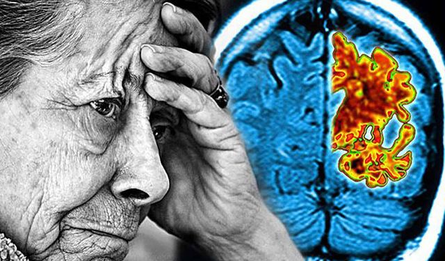 Günlük Yaşamda Görülen Küçük Değişiklikler Alzheimer’ın Erken Habercisi Olabilir