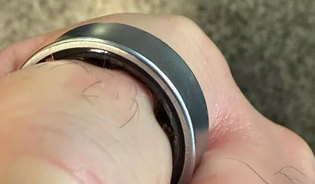 Samsung Galaxy Ring Şişme Olayı Korkuttu: Akıllı Yüzük Hastanede Kesilerek Çıkarıldı